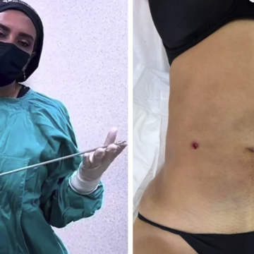 Captura-de-pantalla-2026-05-20-a-las-3.56.04-p.m Clínica clandestina “Detox”: un peligroso menú de procedimientos tras la desaparición de Blanca Adriana