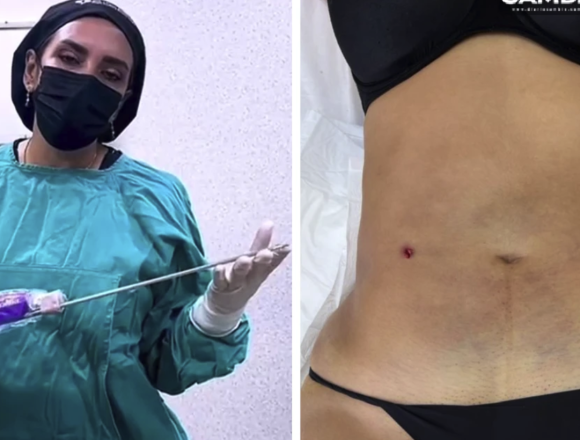 Captura-de-pantalla-2026-05-20-a-las-3.56.04-p.m Clínica clandestina “Detox”: un peligroso menú de procedimientos tras la desaparición de Blanca Adriana