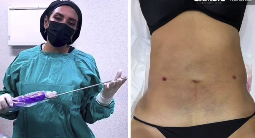 Captura-de-pantalla-2026-05-20-a-las-3.56.04-p.m Clínica clandestina “Detox”: un peligroso menú de procedimientos tras la desaparición de Blanca Adriana